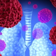Atividade de Ciências: o Câncer e o Surgimento de Vacinas - Anos Finais