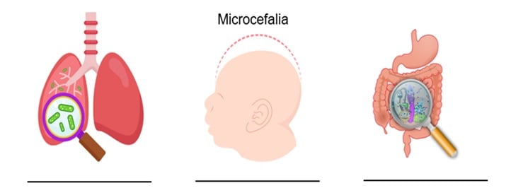 Atividade de mortalidade infantil