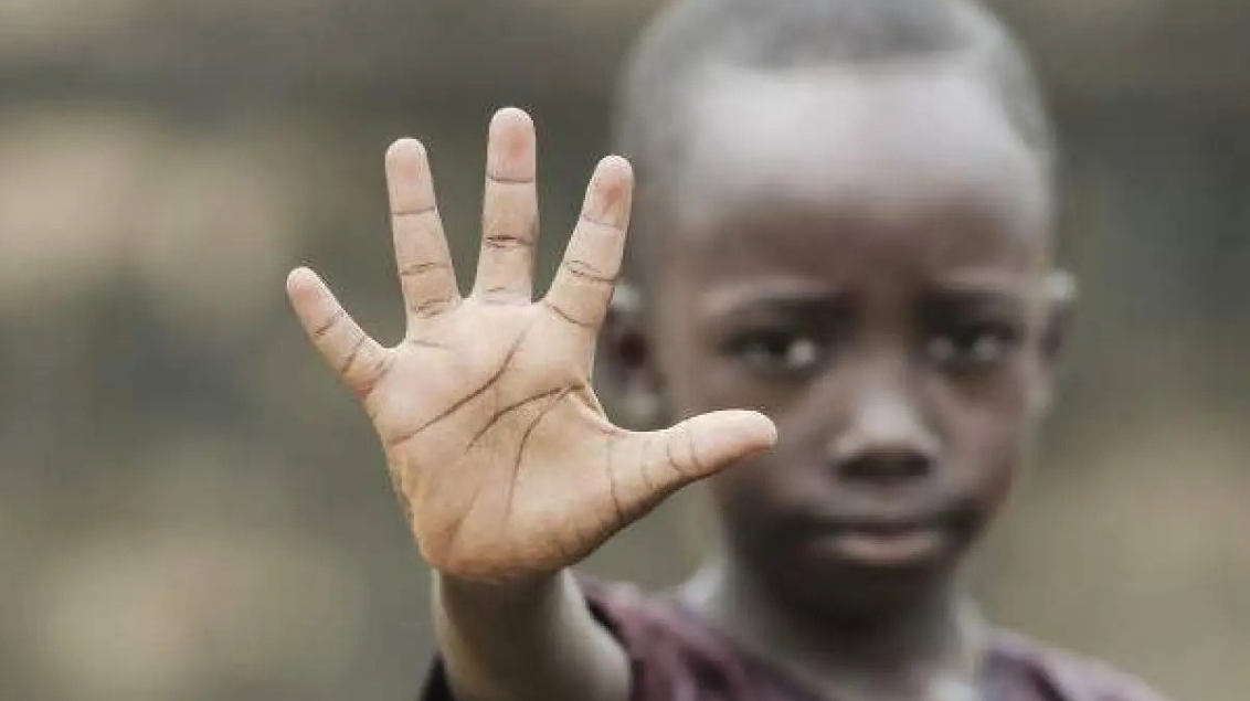 Atividades Escolares de Consciência Negra